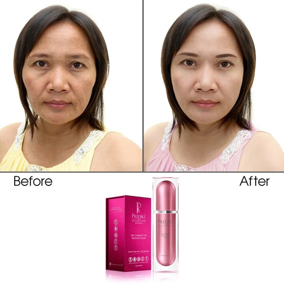 Intensive Cell Renewal Lifting System - Picture 3 of 11